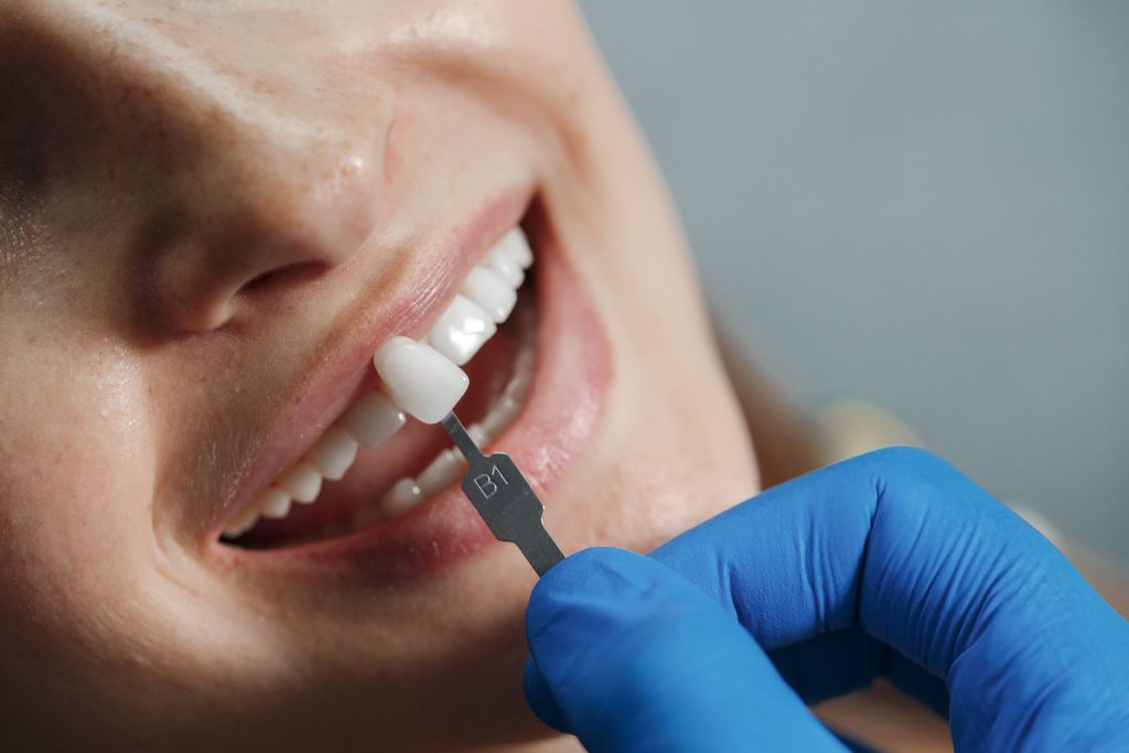 Dental Implants in Strathfield | U Plus Dental