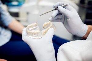 Dental Implants in Strathfield | U Plus Dental